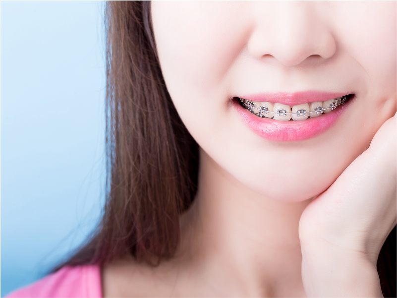 矯正歯科・小児矯正歯科